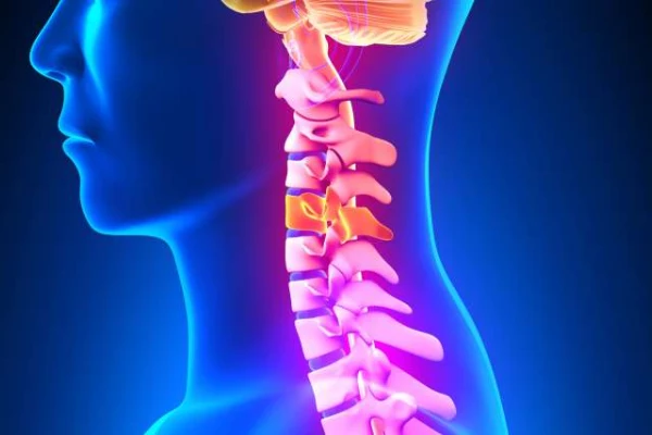 جراحی دیسک و تنگی کانال گردنی - دکتر