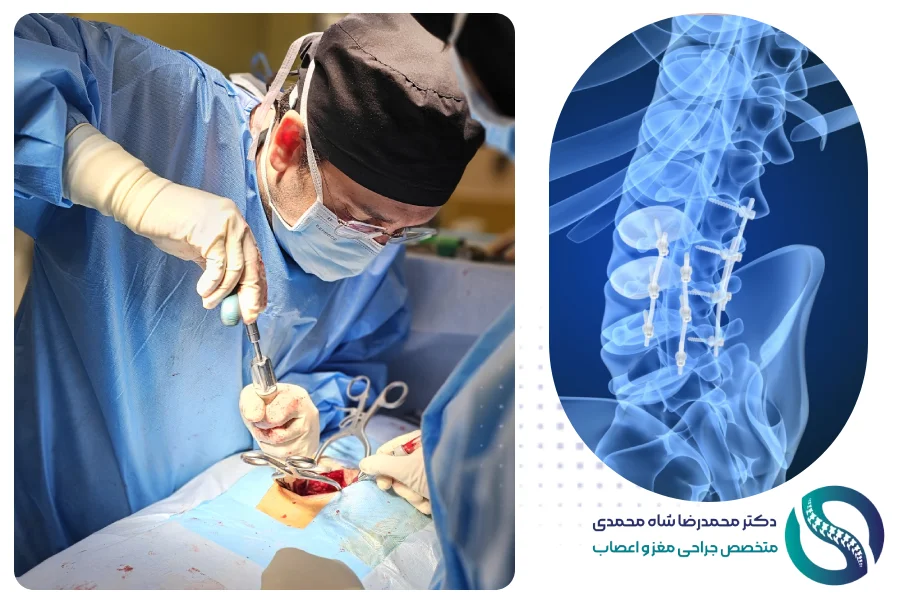 جراحی دیسک کمر - دکتر محمدرضا شاه محمدی