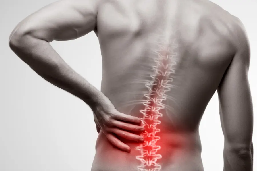 علائم دیسک کمر؛ چگونه بفهمیم دیسک کمر داریم؟ - دکتر محمدرضا شاه محمدی
