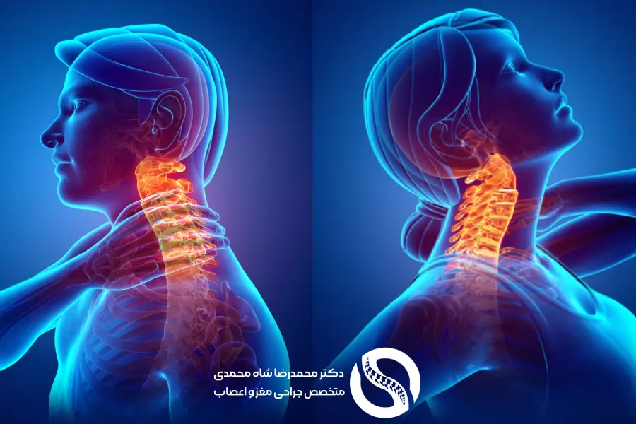 علائم دیسک گردن: راهنمای جامع تشخیص، درمان و پیشگیری - دکتر محمدرضا شاه محمدی