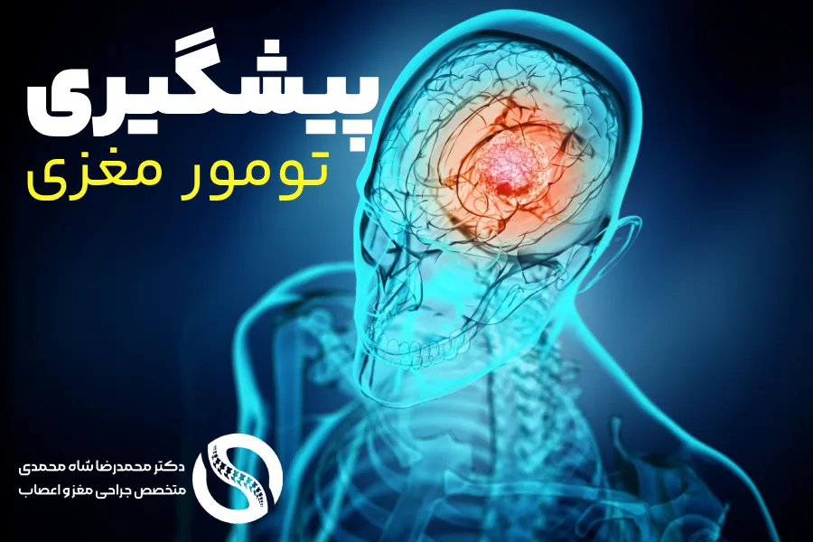 آیا میتوان از تومور مغزی پیشگیری کرد؟ - متاستاز مغزی - دکتر محمدرضا شاه محمدی
