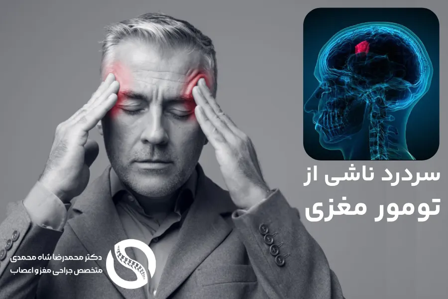 سردردهای ناشی از تومور مغزی - دکتر محمدرضا شاه محمدی