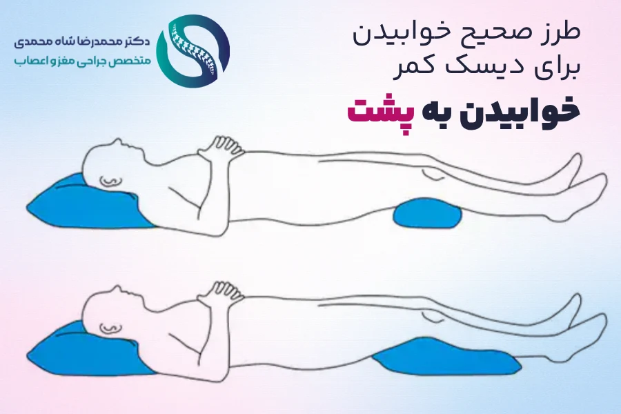 خوابیدن به پشت - طرز صحیح خوابیدن برای دیسک کمر - دکتر محمدرضا شاه محمدی