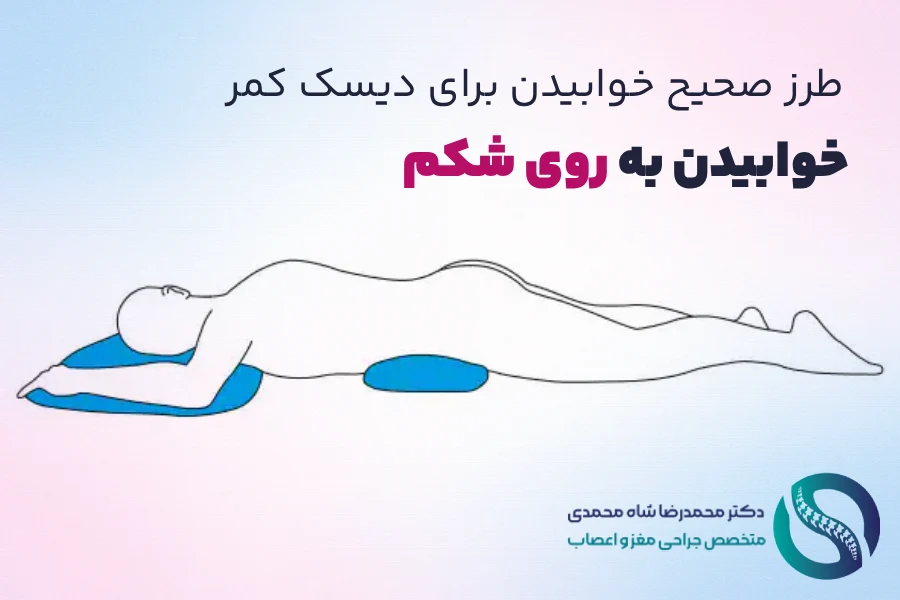 خوابیدن روی شکم - طرز صحیح خوابیدن برای دیسک کمر - دکتر محمدرضا شاه محمدی