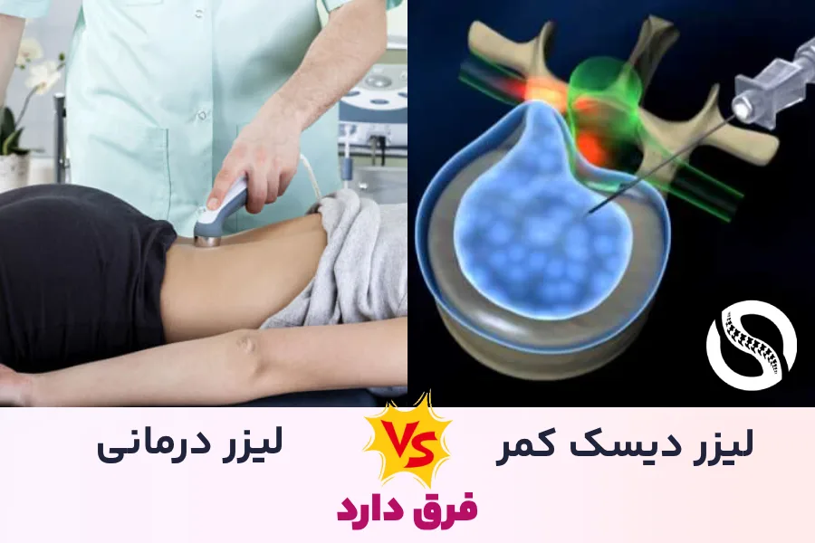 لیزر درمانی کمردرد با عمل لیزر دیسک کمر (PLDD) کاملاٌ متفاوت است