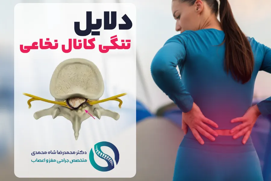 دلیل اصلی تنگی کانال نخاعی - دکتر شاه محمدی جراح دیسک کمر