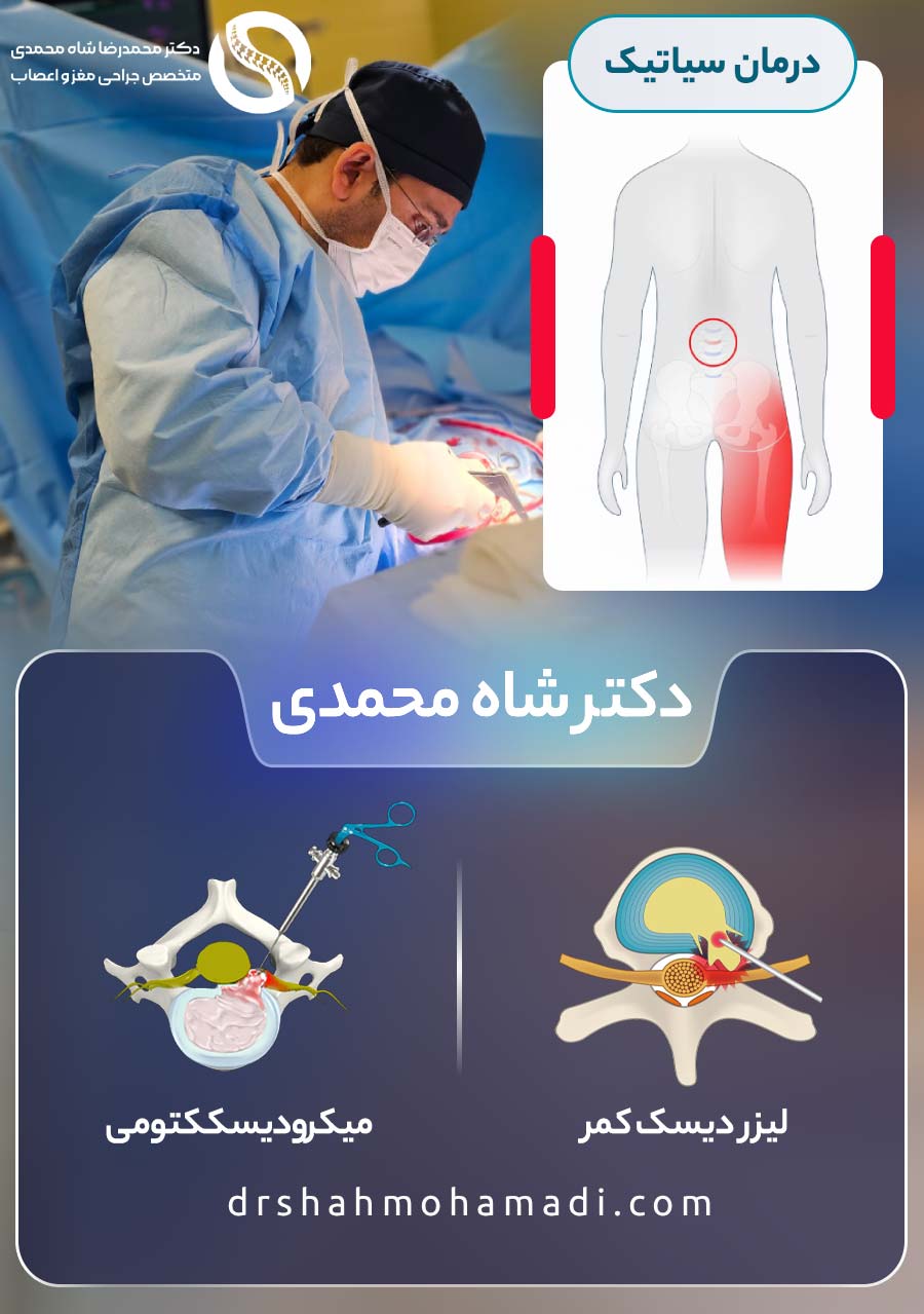 بهترین درمان سیاتیک از نظر دکتر شاه محمدی