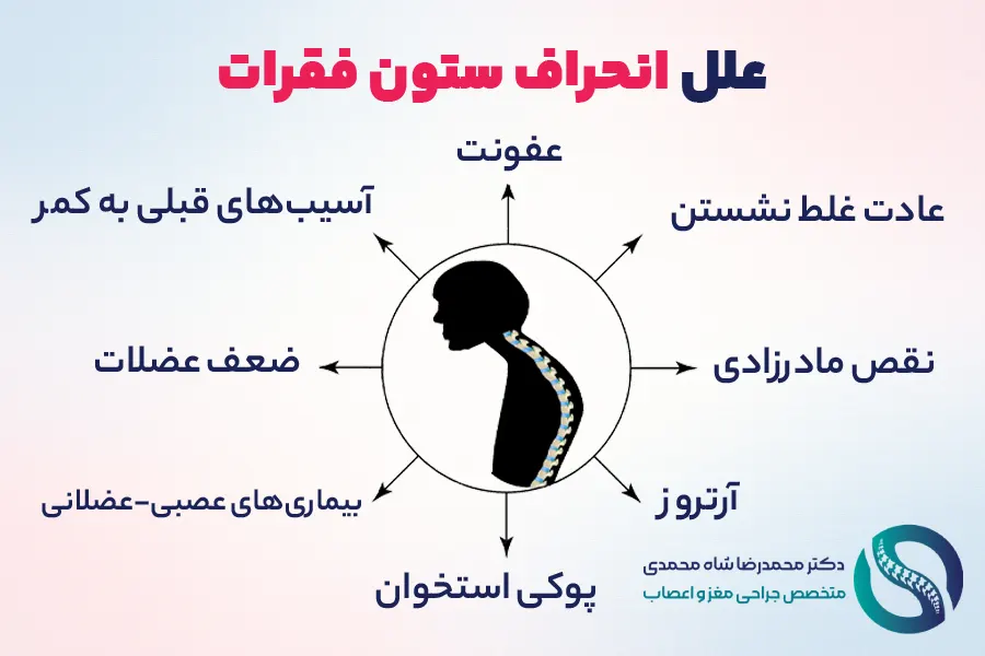 علل انحراف ستون فقرات - دکتر شاه محمدی جراح انحراف ستون فقرات
