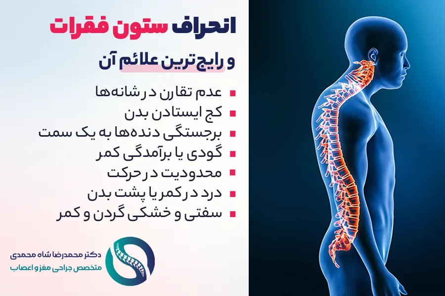 رایج ترین علائم انحراف ستون فقرات - دکتر شاه محمدی جراح انحراف ستون فقرات