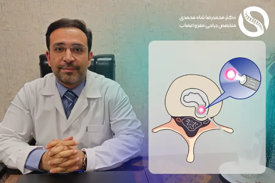 نظرات در مورد عمل دیسک کمر با لیزر - دکتر شاه محمدی جراح دیسک کمر با لیزر