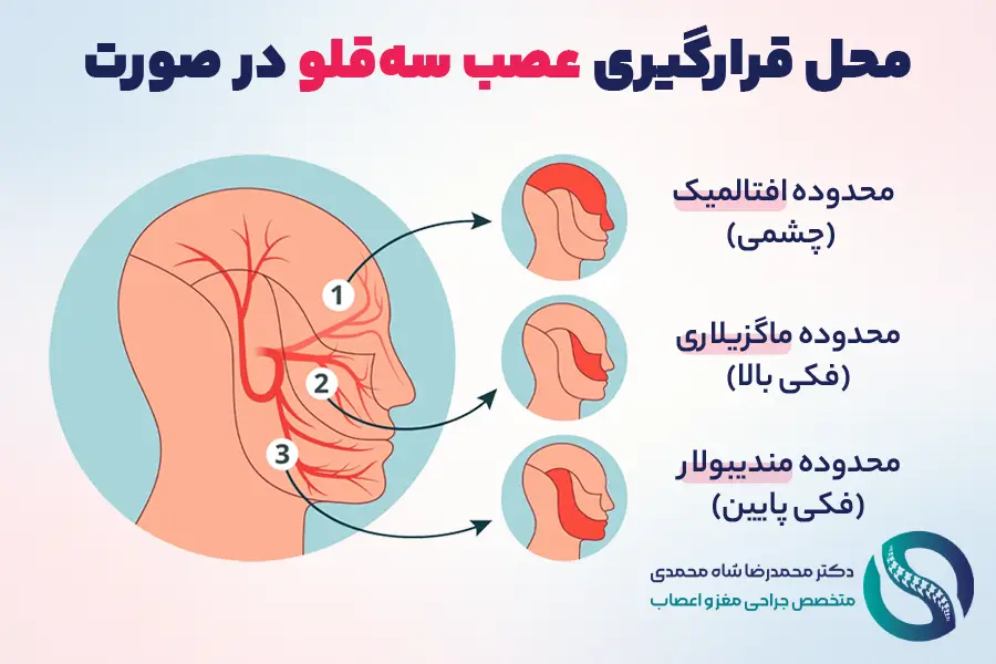 عصب تری ژمینال در کجای بدن قرار دارد؟ - دکتر شاه محمدی