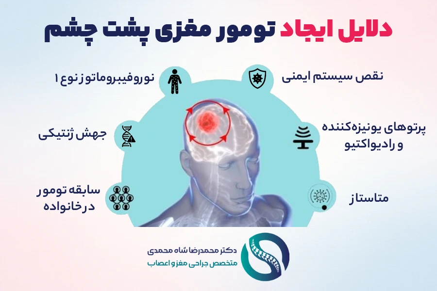 علت بروز تومور مغزی پشت چشم - دکتر محمدرضا شاه محمدی متخصص جراحی مغز و اعصاب در تهران