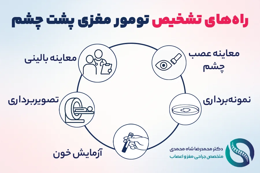 نحوه تشخیص تومور مغزی پشت چشم - دکتر محمدرضا شاه محمدی متخصص جراحی مغز و اعصاب در تهران