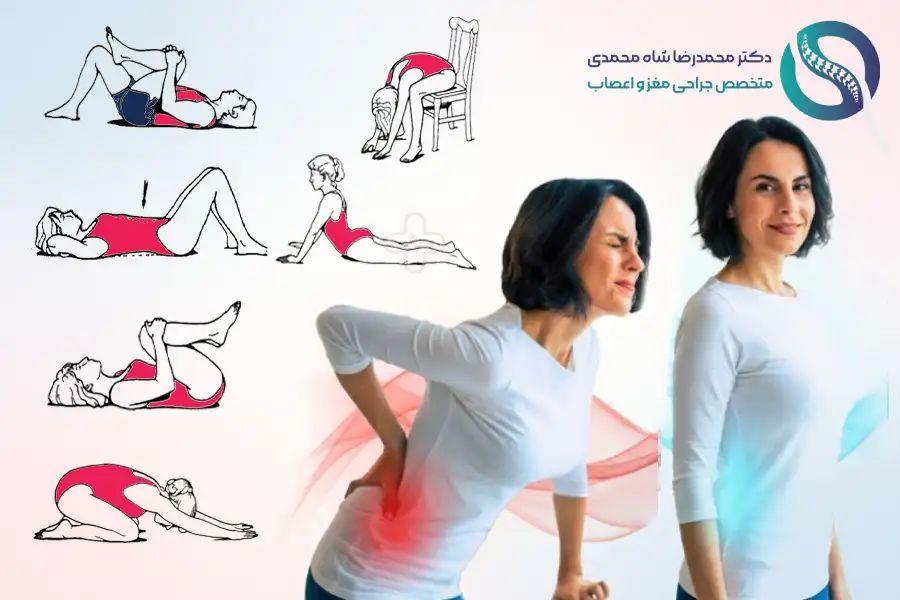 تمرینات ویلیامز برای درمان کمردرد - دکتر شاه محمدی