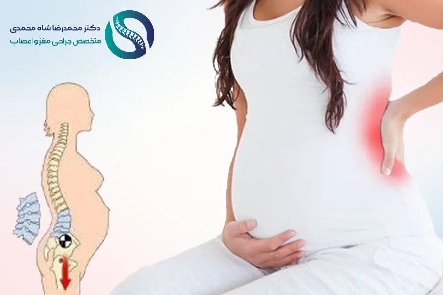 دیسک کمر در بارداری - - دکتر شاه محمدی جراح دیسک کمر