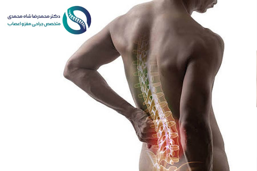 علائم دیسک کمر؛ چگونه بفهمیم دیسک کمر داریم؟ - دکتر محمدرضا شاه محمدی