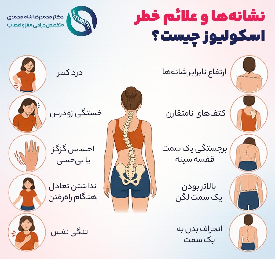 نشانهها و علائم خطر اسکولیوز چیست؟ - دکتر محمدرضا شاه محمدی