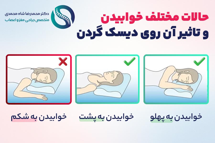 حالات مختلف خوابیدن و تاثیر آن روی دیسک گردن - دکتر محمدرضا شاه محمدی متخصص جراح دیسک گردن