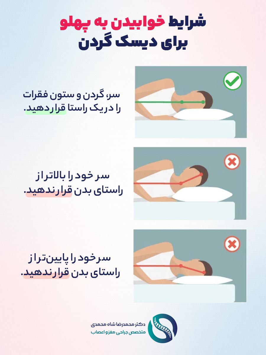 شرایط خوابیدن به پهلو برای دیسک گردن - دکتر محمدرضا شاه محمدی متخصص جراح دیسک گردن