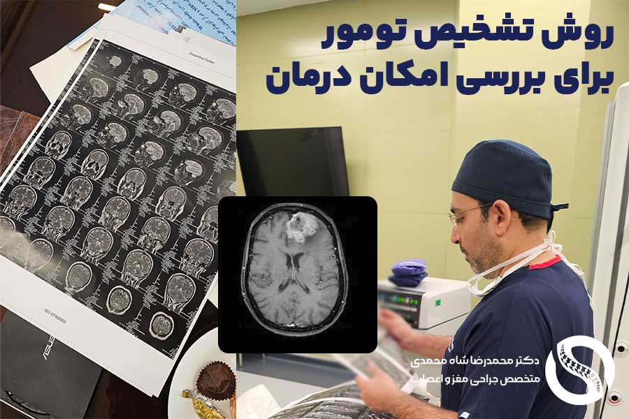 روش تشخیص تومور برای بررسی امکان درمان - دکتر محمدرضا شاه محمدی جراح مغز و اعصاب